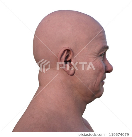 A man's hairless head from side view, 3D illustration A man's hairless head from side view, 3D illustration 119674079