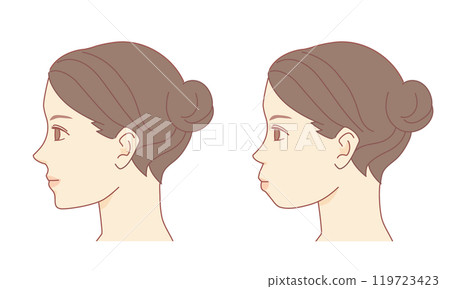 Comparison illustration of side face correction for protruding mouth 119723423