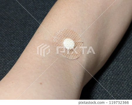 Blood sampling 119732366