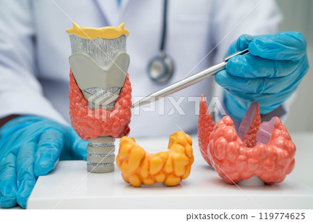 Hyperthyroidism, Overactive Thyroid, Thyroid Lymphoma, Asian doctor with thyroid gland human anatomy model in hospital. 119774625