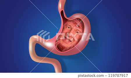 Sick stomach characters. Stomach gastritis, indigestion, vomiting, heartburn problems. Stomach pain and human face. Stomach health. Medical concept. Collage Sick stomach characters. Stomach gastritis, indigestion, vomiting, heartburn problems. Stomach pain and human face. Stomach health. Medical concept. Collage 119787917