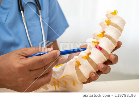Doctor with lumbar vertebra bone skeleton and nerve model for treatment in the orthopedic department. 119788196
