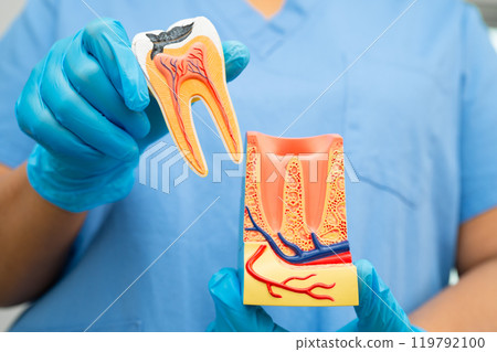 Dental implant, artificial tooth roots into jaw, root canal of dental treatment, gum disease, teeth model for dentist studying about dentistry. Dental implant, artificial tooth roots into jaw, root canal of dental treatment, gum disease, teeth model for dentist studying about dentistry. 119792100