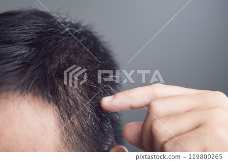 A close-up shot of a man inspecting his premature gray hair, thoughtfully touching the strands on his head. Soft gray background highlights the theme of hair health and the challenges of early A close-up shot of a man inspecting his premature gray hair, thoughtfully touching the strands on his head. Soft gray background highlights the theme of hair health and the challenges of early 119800265