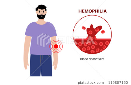 Hemophilia medical poster 119807160
