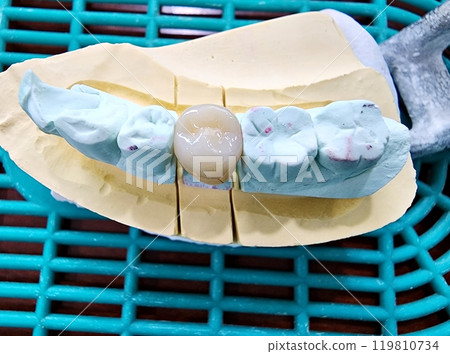 Dental porcelain Crown 119810734