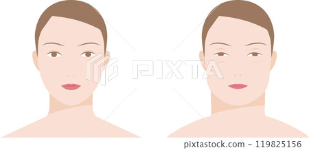 臉部腫脹腫脹的女性前視圖圖解 119825156