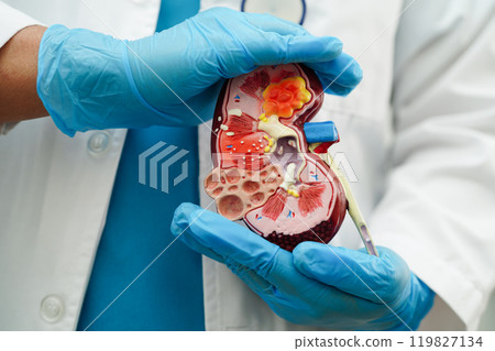 Chronic kidney disease, doctor with model for treatment urinary system, urology, Estimated glomerular filtration rate eGFR. Chronic kidney disease, doctor with model for treatment urinary system, urology, Estimated glomerular filtration rate eGFR. 119827134