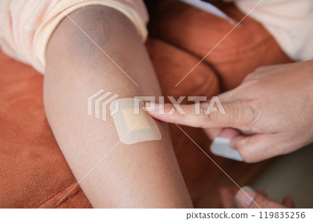 Applying a Bandage on the Elbow Area Following a Minor Injury for Proper Care and Healing Applying a Bandage on the Elbow Area Following a Minor Injury for Proper Care and Healing 119835256