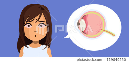 Woman With Red Eyes Suffering Fatigue Vector Illustration 119849230