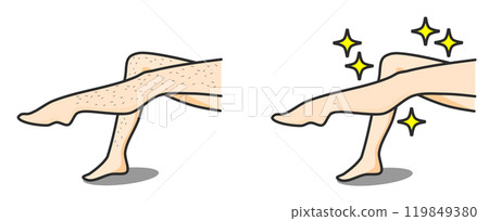 女人除毛後雙腿變得漂亮,皮膚光滑裸露 女人除毛後雙腿變得漂亮,皮膚光滑裸露 119849380