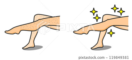 女人除毛後雙腿變得漂亮,皮膚光滑裸露 女人除毛後雙腿變得漂亮,皮膚光滑裸露 119849381