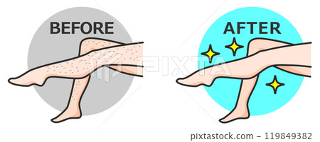 女人除毛後雙腿變得漂亮,皮膚光滑裸露 女人除毛後雙腿變得漂亮,皮膚光滑裸露 119849382