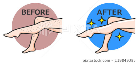 女人除毛後雙腿變得漂亮,皮膚光滑裸露 女人除毛後雙腿變得漂亮,皮膚光滑裸露 119849383