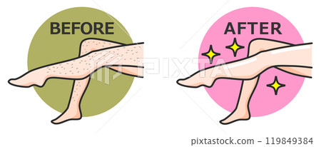 A woman's legs that have been depilated and now have smooth, beautiful skin 119849384