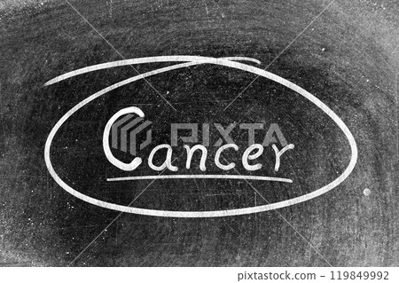 White chalk hand writing in word cancer and circle shape on blackboard background 119849992