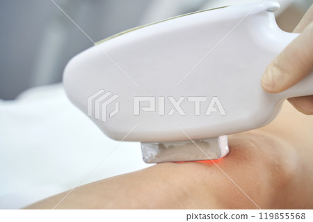 Laser hair removal procedure close up in modern beauty clinic with advanced 119855568