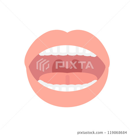 口內插圖 口內插圖 119868684