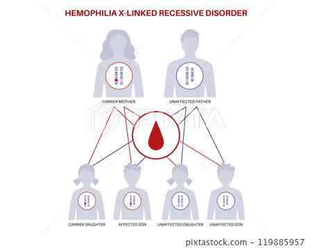 Hemophilia inheritance poster 119885957