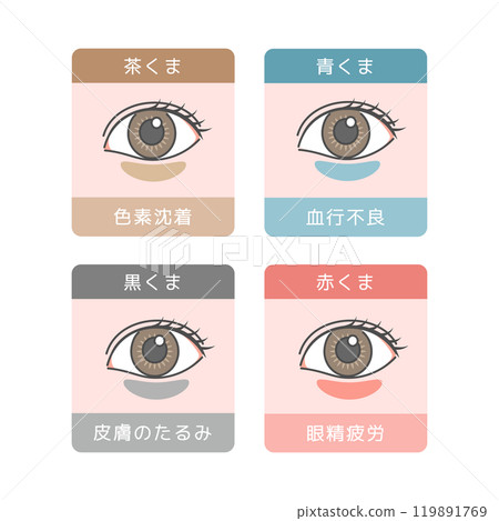 Eye bags types illustration set Eye bags types illustration set 119891769