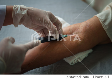 Close up of doctor or nurse taking a blood sample from arm vein with vacutainer. syringe to venipuncture the patient 119894991
