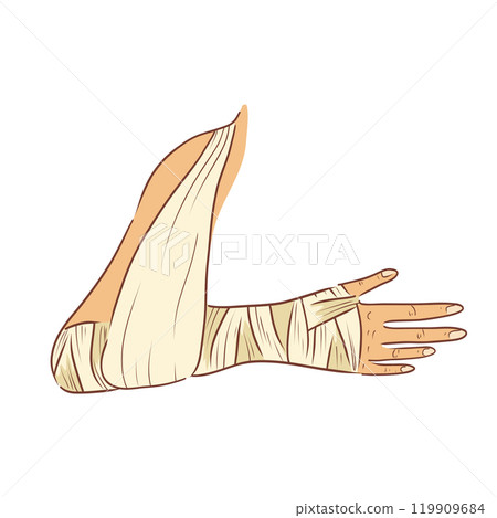 Bandaged hand with support in flat design. Broken arm with bandage gypsum. Vector illustration isolated. 119909684