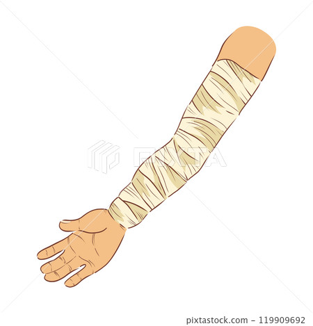 Bandaged hand in flat design. Broken human arm with bandage dressing. Vector illustration isolated. 119909692