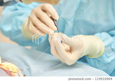 Surgical precision: surgeon's gloved hands performing delicate medical procedure 119910904