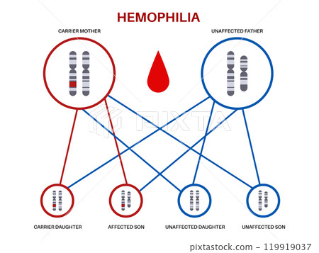 Hemophilia inheritance poster 119919037