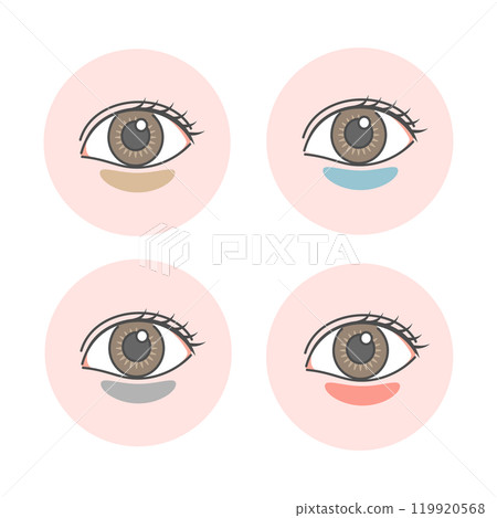 Set of illustrations of types of dark circles under the eyes (no explanation) 119920568