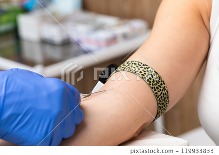 Nurse taking a blood sample from a patients arm Nurse taking a blood sample from a patients arm 119933833