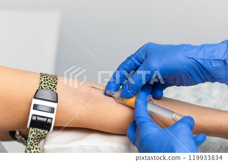 Nurse taking a blood sample from a patients arm 119933834