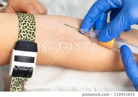 Nurse taking a blood sample from a patients arm 119933835