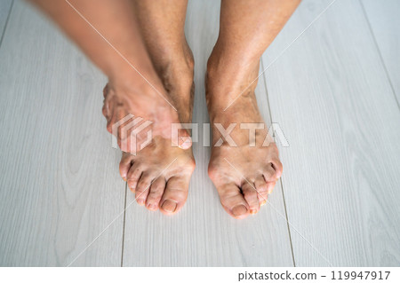 Naked legs of woman suffering from painful bone on legs. Female arm hand touching aching legs. 119947917