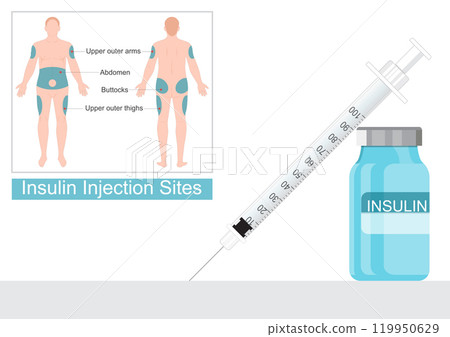 Injection sites suitable for an insulin injection. 119950629