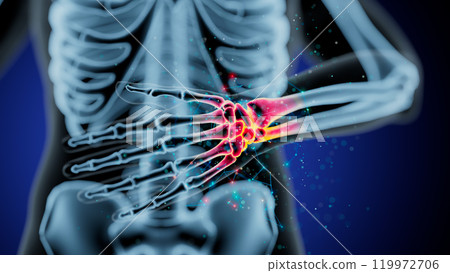 Illuminated Human Skeleton: Highlighting Elbow and Wrist Pain Illuminated Human Skeleton: Highlighting Elbow and Wrist Pain 119972706