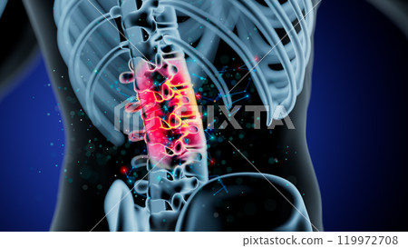 Illuminated Spine: A Study of Inflammation and Anatomical Detail Illuminated Spine: A Study of Inflammation and Anatomical Detail 119972708