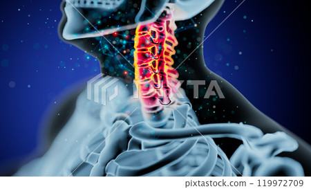 Vibrant Illustration of the Human Cervical Spine on Dark Background 119972709