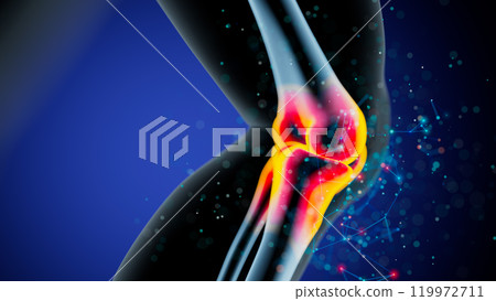 Highlighted Inflammation in the Knee Joint Against a Soothing Blue Background 119972711