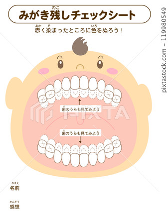 Checklist for brushing areas that are not properly cleaned during the primary dentition stage - Dye-bleached illustrations 119980549