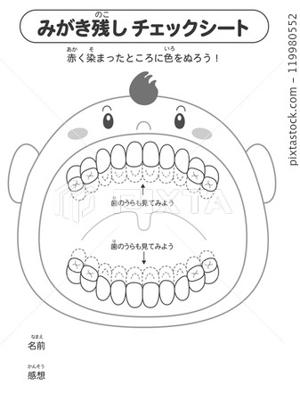 初級牙列階段未拋光牙齒的黑白檢查表 — 染色插圖 初級牙列階段未拋光牙齒的黑白檢查表 — 染色插圖 119980552