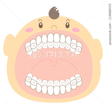 檢查嬰兒牙列期間是否有未拋光的牙齒 — 染色插圖 119980555