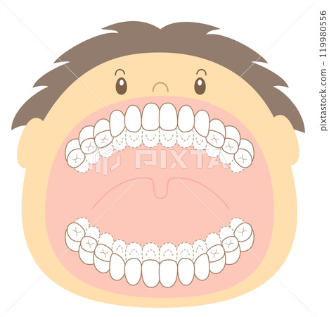 Mixed dentition stage checklist for areas not brushed properly - dyed illustrations 119980556