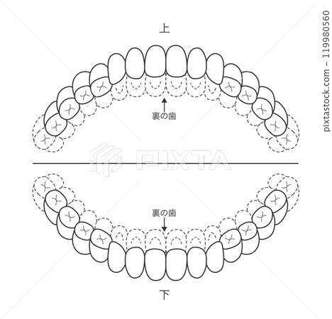 恆牙列階段未拋光部份的黑白檢查表 — 染色插圖 恆牙列階段未拋光部份的黑白檢查表 — 染色插圖 119980560