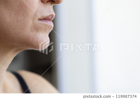 Unwanted facial hair. Woman has excessive hair on her face. Closeup. 119987374
