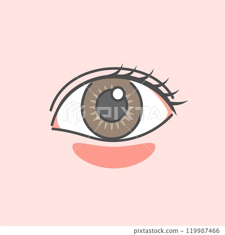 Illustration of types of dark circles under the eyes (red dark circles) 119987466
