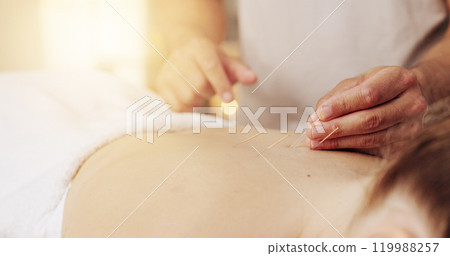 Acupuncture, hands and stress relief in spa with customer for healing, holistic therapy or to relax. Body, dry needling and treatment with masseuse in resort for cosmetics, massage and skincare Acupuncture, hands and stress relief in spa with customer for healing, holistic therapy or to relax. Body, dry needling and treatment with masseuse in resort for cosmetics, massage and skincare 119988257