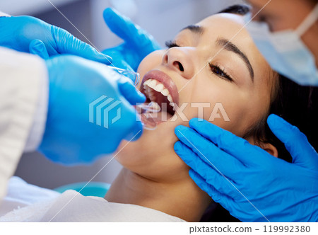 Face, hands and operation with woman at dentist for oral hygiene or dental care appointment closeup. Healthcare, medical and surgery with patient in chair at clinic for cleaning, exam pr procedure 119992380