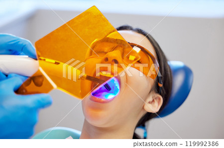 Blue light, face and visor with woman at dentist for oral hygiene or dental care appointment closeup. Filling, healthcare and medical equipment with patient in chair at clinic for tooth repair 119992386
