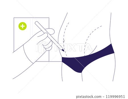 Abdominoplasty abstract concept vector illustration. 119996951
